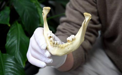 Identification dentaire lors d'une catastrophe