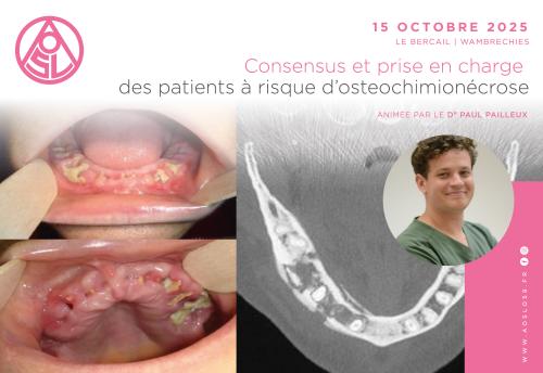 Consensus et prise en charge des patients à risque d’osteochimionécrose