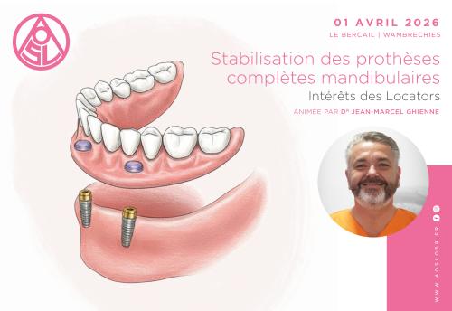 Stabilisation des prothèses complètes mandibulaires | Intérêt des Locators
