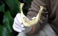 Identification dentaire lors d'une catastrophe