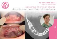 Consensus et prise en charge des patients à risque d’osteochimionécrose
